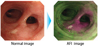 Image Comparison