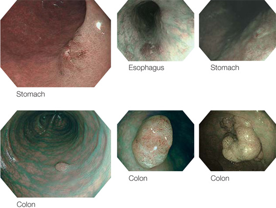 Stomach/Colon