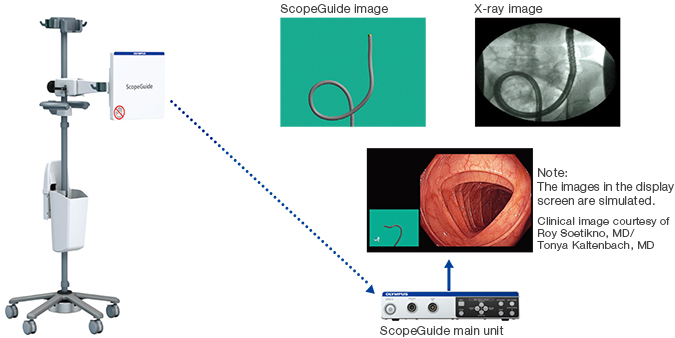 scope guide image